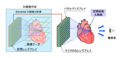 IV_system_01_jp.jpg